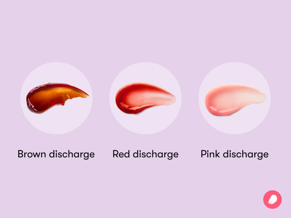 The color of vaginal discharge can fluctuate throughout various stages of your cycle. However, it is advisable to seek a healthcare provider's opinion if the irregular color of the discharge is accompanied by other symptoms like odor or soreness.