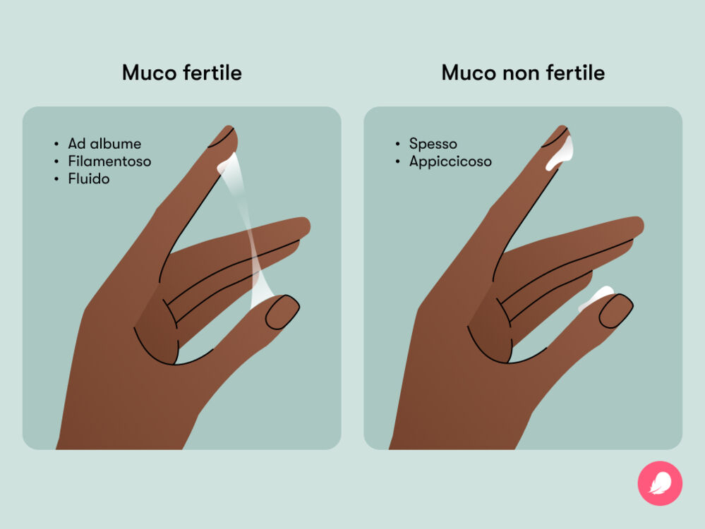 Illustrazione che mostra la differenza tra muco cervicale fertile e muco cervicale non fertile