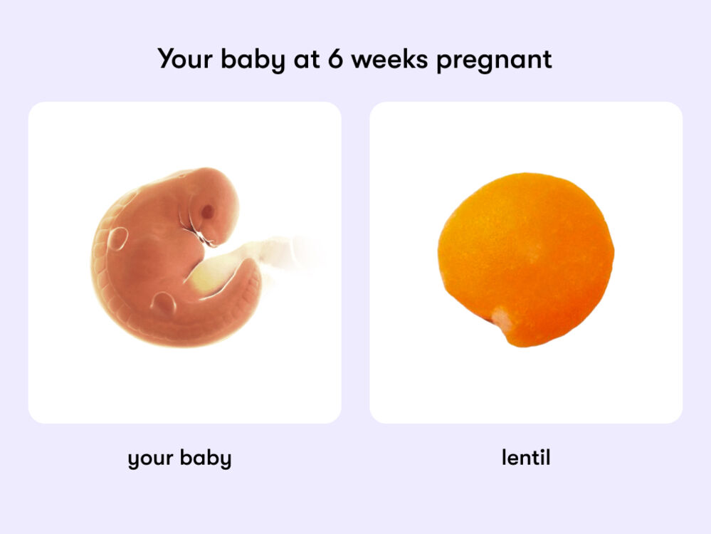 At week 6 of pregnancy, the baby is around 5 mm long, equivalent to the size of a lentil
