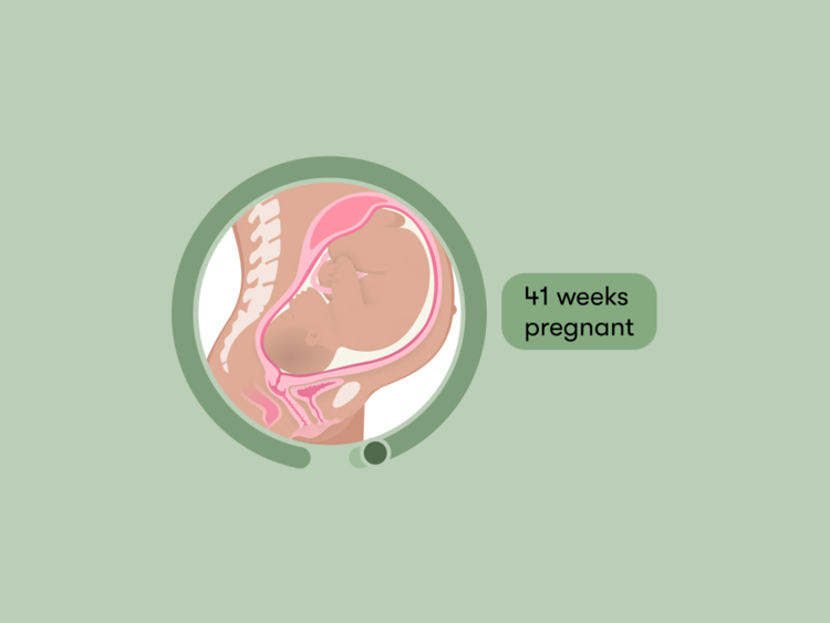 41 weeks pregnant: Your guide to this week of your third trimester